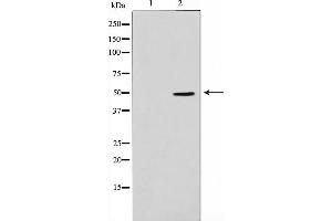 Western blot analysis on Jurkat cell lysate using ADPGK Antibody,The lane on the left is treated with the antigen-specific peptide. (ADPGK anticorps  (Internal Region))