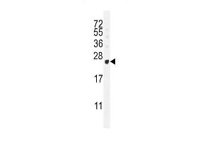 GAGE12B Antibody (N-term) (ABIN655201 and ABIN2844816) western blot analysis in T47D cell line lysates (35 μg/lane). (G Antigen 12B anticorps  (N-Term))