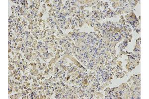 Immunohistochemistry (IHC) image for anti-Nudix (Nucleoside Diphosphate Linked Moiety X)-Type Motif 1 (NUDT1) antibody (ABIN1876662) (NUDT1 anticorps)