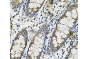 Immunohistochemistry of paraffin-embedded Human colon using DEFB132 Polyclonal Antibody at dilution of 1:100 (40x lens). (DEFB132 anticorps)