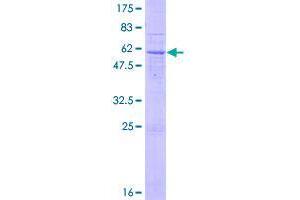 Image no. 1 for ADP-Ribosyltransferase 5 (ART5) (AA 1-292) protein (GST tag) (ABIN1345766)