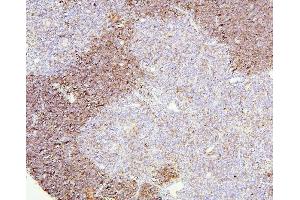 IHC analysis of CD8A using anti-CD8A antibody (ABIN6719524).