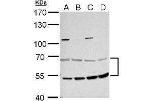 WB Image MCD antibody detects MCD protein by western blot analysis.