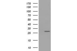 Western Blotting (WB) image for anti-OTU Domain, Ubiquitin Aldehyde Binding 2 (OTUB2) antibody (ABIN1499939) (OTUB2 anticorps)