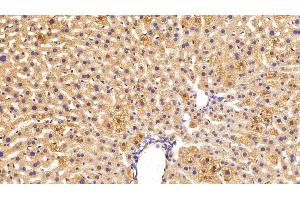 Detection of C3 Convertase in Mouse Liver Tissue using Polyclonal Antibody to Complement C3 Convertase (C3 Convertase) (Complement C3 Convertase anticorps)