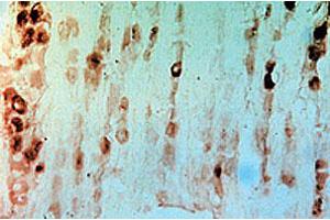 Immunohistochemical staining of rat dorsal root ganglia using rabbit Gfra3 polyclonal antibody  . (GFRA3 anticorps  (AA 1-11))