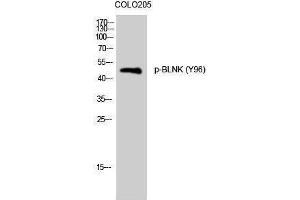 Western Blotting (WB) image for anti-B-Cell Linker (BLNK) (pTyr96) antibody (ABIN3182572) (B-Cell Linker anticorps  (pTyr96))