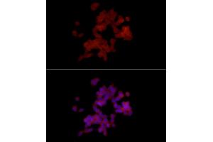 Immunofluorescence analysis of SH-SY5Y cells using PGP9.