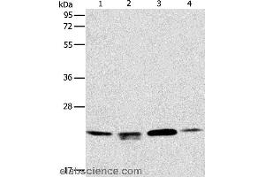 Western blot analysis of 293T, hela and PC3 cell, human liver cancer tissue, using PRDX2 Polyclonal Antibody at dilution of 1:750 (Peroxiredoxin 2 anticorps)