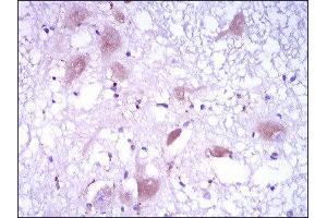 Immunohistochemistry (IHC) image for anti-DKK3 (AA 91-350) antibody (ABIN1846139)
