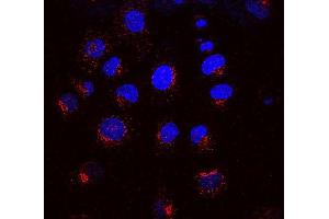 Immunocytochemistry/Immunofluorescence analysis using Mouse Anti-KDEL Receptor Monoclonal Antibody, Clone KR-10 . (KDELR anticorps  (AA 192-212) (Biotin))