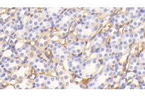 Detection of ALB in Rat Kidney Tissue using Polyclonal Antibody to Albumin (ALB)
