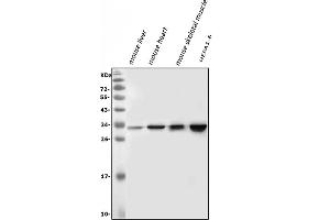 Western blot analysis of VAPB using anti-VAPB antibody (ABIN5693292). (VAPB anticorps  (AA 2-55))