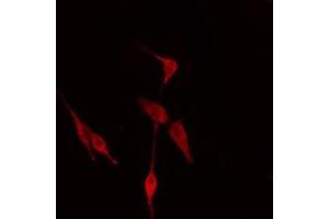 ABIN6276548 staining Hela cells by IF/ICC.
