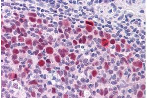 Human Tonsil: Formalin-Fixed, Paraffin-Embedded (FFPE)