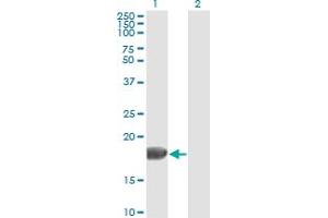 Western Blot analysis of FGF1 expression in transfected 293T cell line by FGF1 monoclonal antibody (M02), clone 2E12.