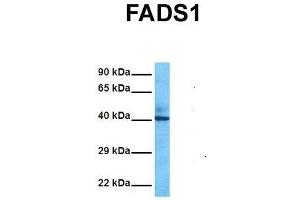 Host:  Rabbit  Target Name:  FADS1  Sample Tissue:  Human Fetal Liver  Antibody Dilution:  1. (FADS1 anticorps  (C-Term))