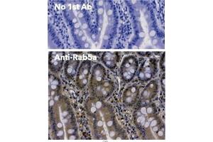 Immunohistochemistry (IHC) image for anti-RAB5A, Member RAS Oncogene Family (RAB5A) (C-Term) antibody (ABIN1439994)