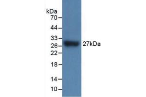 Detection of Recombinant IL17RC, Mouse using Polyclonal Antibody to Interleukin 17 Receptor C (IL17RC)