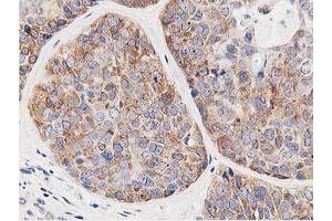 Immunohistochemistry (IHC) image for anti-Leucine Carboxyl Methyltransferase 1 (LCMT1) antibody (ABIN1499107) (LCMT1 anticorps)