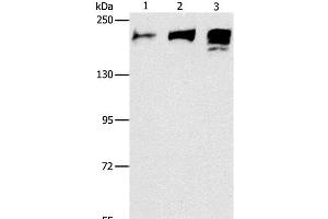 Western Blot analysis of Human ileum adenocarcinoma tissue, Human testis and prostate tissue using ACE1 Polyclonal Antibody at dilution of 1:240 (Angiotensin I Converting Enzyme 1 anticorps)