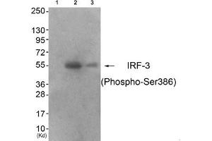 Western blot analysis of extracts from 293 cells (Lane 2) and colo cells (Lane 3), using IRF-3 (Phospho-Ser386) Antibody. (IRF3 anticorps  (pSer386))