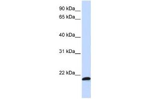 Western Blotting (WB) image for anti-Chromosome 21 Open Reading Frame 56 (C21orf56) antibody (ABIN2458971) (C21ORF56 anticorps)