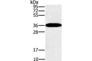Western Blot analysis of Mouse brain tissue using PPP1CC Polyclonal Antibody at dilution of 1:200 (PPP1CC anticorps)