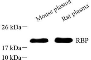 Western blot analysis of RBP (ABIN7075409) at dilution of 1: 500 (RBP4 anticorps)