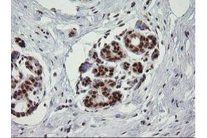 Image no. 2 for anti-tRNA Methyltransferase 2 Homolog A (TRMT2A) antibody (ABIN1501516)