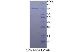 SDS-PAGE (SDS) image for CD63 (CD63) (AA 103-203) protein (His tag,GST tag) (ABIN2123649)