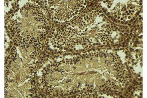 ABIN6277682 at 1/100 staining Mouse testis tissue by IHC-P. (PIAS2 anticorps  (N-Term))
