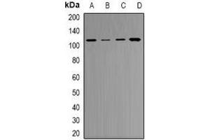 Western blot analysis of RB1 expression in A549 (A), NIH3T3 (B), K562 (C), PC12 (D) whole cell lysates. (Retinoblastoma 1 anticorps)