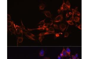 Immunofluorescence analysis of NIH-3T3 cells using DKK3 Polyclonal Antibody at dilution of 1:100 (40x lens). (DKK3 anticorps)