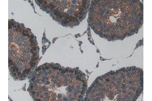 Detection of ND5 in Rat Testis Tissue using Polyclonal Antibody to NADH Dehydrogenase 5 (ND5)