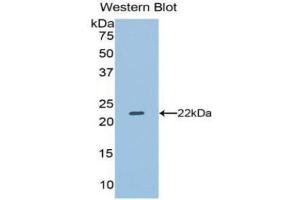 Western Blotting (WB) image for anti-Dual Specificity Phosphatase 3 (DUSP3) (AA 2-185) antibody (ABIN3201776) (Dual Specificity Phosphatase 3 (DUSP3) (AA 2-185) anticorps)