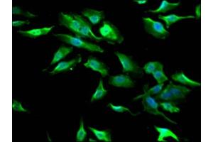 Immunofluorescence staining of Hela Cells with  at 1:50, counter-stained with DAPI. (Recombinant GSK3 beta anticorps)