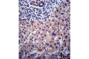 CYP3A4 Antibody (Center) ABIN392216 immunohistochemistry analysis in formalin fixed and paraffin embedded human liver tissue followed by peroxidase conjugation of the secondary antibody and DAB staining.