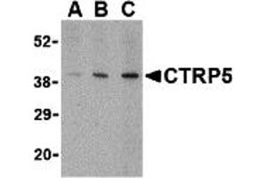 Western Blotting (WB) image for anti-C1q and Tumor Necrosis Factor Related Protein 5 (C1QTNF5) (Middle Region) antibody (ABIN1030914) (CTRP5 anticorps  (Middle Region))