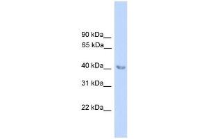 ALAD antibody used at 0.
