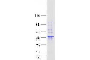 Validation with Western Blot