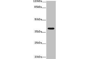 Western blot All lanes: Interleukin-12 subunit beta antibody at 14 μg/mL + K562 whole cell lysate Secondary Goat polyclonal to rabbit IgG at 1/10000 dilution Predicted band size: 37 kDa Observed band size: 37 kDa (IL12B anticorps  (AA 23-327))