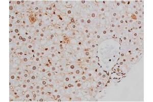 ABIN6267365 at 1/200 staining Rat liver tissue sections by IHC-P.