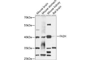 Western blot analysis of extracts of various cell lines, using FH antibody (ABIN6130395, ABIN6140411, ABIN6140413 and ABIN6218027) at 1:3000 dilution. (FA2H anticorps  (AA 95-170))