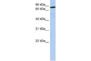 SEMA4B antibody used at 1 ug/ml to detect target protein. (SEMA4B anticorps  (N-Term))