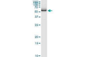 Immunoprecipitation of ATP6V1H transfected lysate using anti-ATP6V1H MaxPab rabbit polyclonal antibody and Protein A Magnetic Bead , and immunoblotted with ATP6V1H purified MaxPab mouse polyclonal antibody (B01P) .