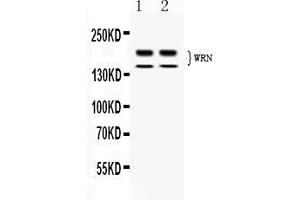 Western blot analysis of WRN expression in rat thymus extract ( Lane 1) and human placenta extract ( Lane 2). (RECQL2 anticorps  (AA 122-240))