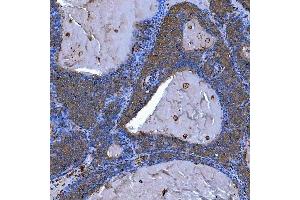 IHC analysis of SEMA4F using anti-SEMA4F antibody (ABIN7601432).
