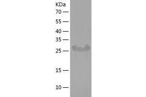 Western Blotting (WB) image for Signal Transducing Adaptor Family Member 1 (STAP1) (AA 1-295) protein (His-IF2DI Tag) (ABIN7125098)