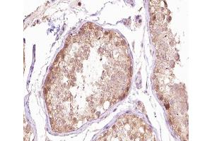 ABIN6266666 at 1/100 staining human testis tissue sections by IHC-P.